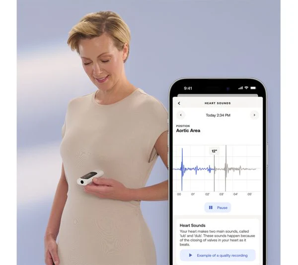Withings BeamO - Portable 4-in-1 Health Monitor ECG, Stethoscope, SpO2 & Temperature | 78-SCT02-02-All-Int - Image 8